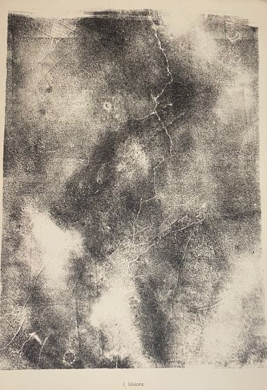 Lesions is an original lithograph on watermarked paper "Arc". Abstract composition by the French artist Jean Dubuffet. From the album of "Territoires" (1953-1959). In excellent conditions.