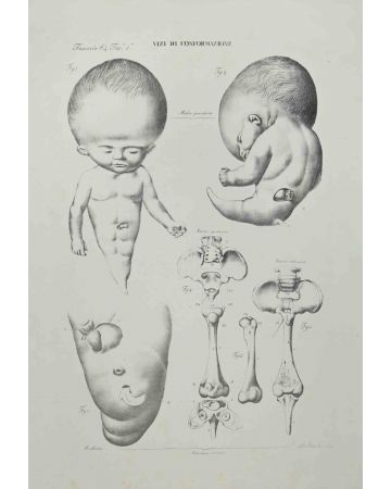 Ottavio Muzi - Conformation Defects - Old Masters 