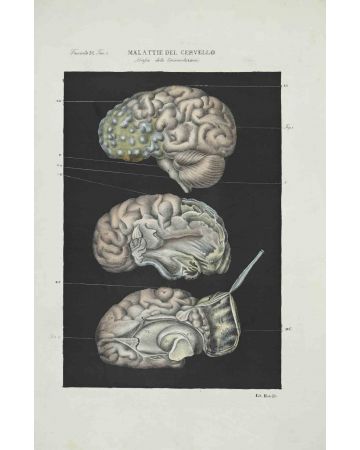 Ottavio Muzzi - Brain Diseases - Modern Artwork 

