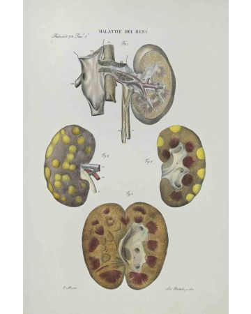 Ottavio Muzzi - Kidney Disease - Contemporary Art 